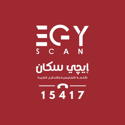 ايجي سكان